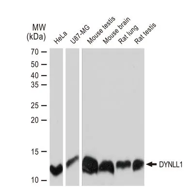 WB analysis of various samples using GTX03236 DYNLL1 antibody [GT1324]. Dilution : 1:1000 Loading : 25microg per lane