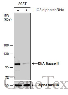 DNA ligase III antibody [C2C3],C-term detects DNA ligase III protein at nucleus by immunofluorescent analysis.