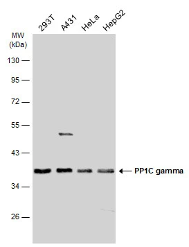 Immunofluorescence analysis of paraformaldehyde-fixed HeLa,using PP1 gamma(GTX105618) antibody at 1:200 dilution.