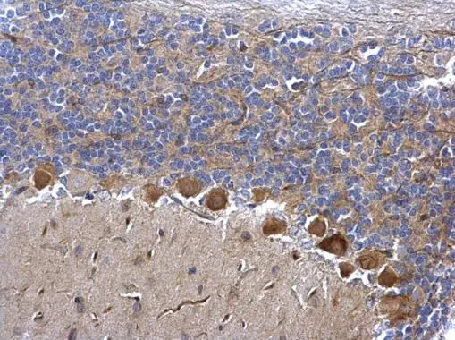 CDK5 antibody [C2C3],C-term detects CDK5 protein at cytosol on rat hind brain by immunohistochemical analysis. Sample: Paraffin-embedded rat hind brain. CDK5 antibody [C2C3],C-term (GTX108328) Antigen Retrieval: Trilogy? (EDTA based,pH 8.0) buffer,15min
