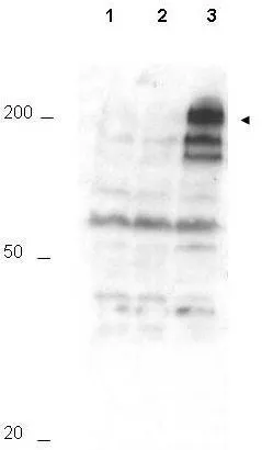 Western blot using GeneTex Affinity Purified anti-APC1 pS355 antibody (GTX10923) shows detection of a band ~215 kDa corresponding to phosphorylated human APC1 (arrowhead).