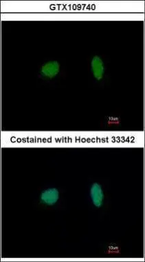MCM4 antibody detects MCM4 protein by western blot analysis. A. 30 ug Jurkat whole cell lysate/extract B. 30 ug Raji whole cell lysate/extract C. 30 ug NCI-H929 whole cell lysate/extract 7.5 % SDS-PAGE MCM4 antibody (GTX109740) dilution: 1:5000