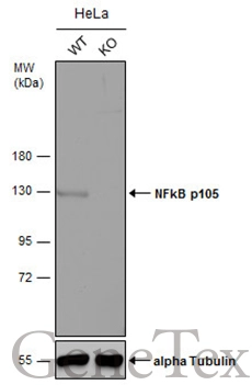 Immunofluorescence analysis of paraformaldehyde-fixed HeLa,using NFkB p105(GTX110585) antibody at 1:200 dilution.