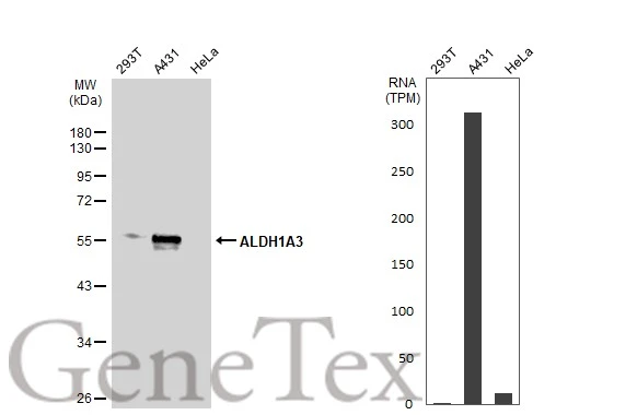 ALDH1A3 antibody [N2C2],Internal detects ALDH1A3 protein at cytoplasm by immunohistochemical analysis.