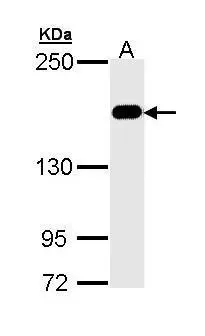 MSH6 antibody [C1C2],Internal detects MSH6 protein by Western blot analysis. A.30 ug Neuro2A whole cell lysate/extract B.30 ug GL261 whole cell lysate/extract 5% SDS-PAGE MSH6 antibody [C1C2],Internal (GTX111661).