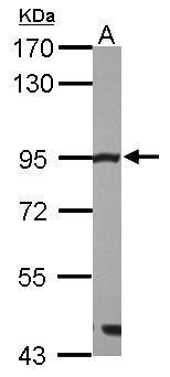 Non-transfected (�) and transfected (+) HeLa whole cell extracts (30 ug) were separated by 7.5% SDS-PAGE,and the membrane was blotted with Mre11 antibody [C1C3-2] (GTX111814) diluted at 1:1000.
