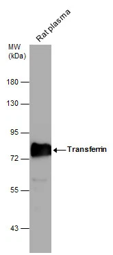 Rat tissue extract (50 ug) was separated by 7.5% SDS-PAGE,and the membrane was blotted with Transferrin antibody [N3C2],Internal (GTX112729) diluted at 1:1000.