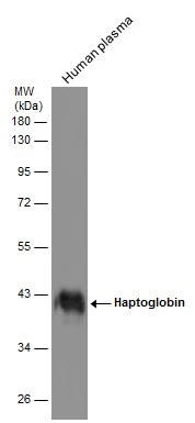 Haptoglobin antibody detects Haptoglobin protein by Western blot analysis.