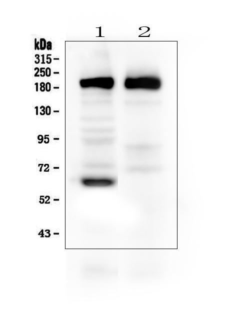 WB analysis of various samples using GTX11699 Thrombospondin 2 antibody.