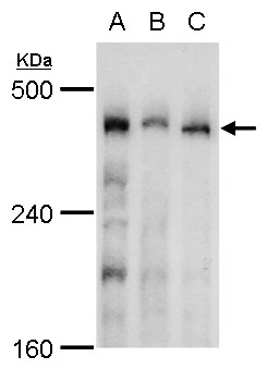 TRRAP antibody detects TRRAP protein by western blot analysis. A. 30 ug Jurkat whole cell lysate/extract B. 30 ug Raji whole cell lysate/extract C. 30 ug NCI-H929 whole cell lysate/extract 5 % SDS-PAGE TRRAP antibody (GTX129507) dilution: 1:1000