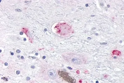 IHC-P analysis of brain, substantia nigra, pigmented and nonpigmented neurons tissue using GTX13072 OR10R2 antibody.