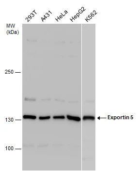 Various whole cell extracts (30 ug) were separated by 5% SDS-PAGE,and the membrane was blotted with Exportin 5 antibody (GTX130727) diluted at 1:1000.
