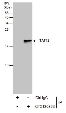 TAF12 antibody detects TAF12 protein by western blot analysis. Various whole cell extracts (30 ug) were separated by 15% SDS-PAGE,and the membrane was blotted with TAF12 antibody (GTX130863) diluted at 1:1000.