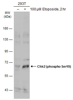 Untreated (�) and treated (+) 293T whole cell extracts (30 ug) were separated by 7.5% SDS-PAGE,and the membrane was blotted with Chk2 (phospho Ser19) antibody (GTX133989) diluted at 1:500.