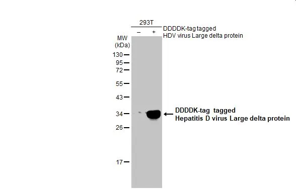 Non-transfected (-) and transfected (+) 293T whole cell extracts (30 microg) were separated by 12% SDS-PAGE, and the membrane was blotted with Hepatitis D virus Large delta protein antibody (GTX135574) diluted at 1:5000. The HRP-conjugated anti-rabbit IgG antibody (GTX213110-01) was used to detect the primary antibody.
