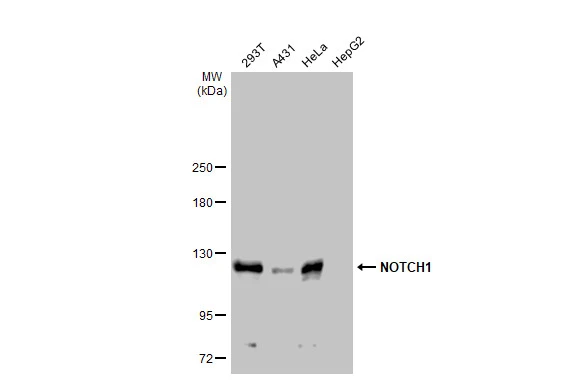 Various whole cell extracts (30 microg) were separated by 5% SDS-PAGE, and the membrane was blotted with NOTCH1 antibody (GTX135786) diluted at 1:1000. The HRP-conjugated anti-rabbit IgG antibody (GTX213110-01) was used to detect the primary antibody.