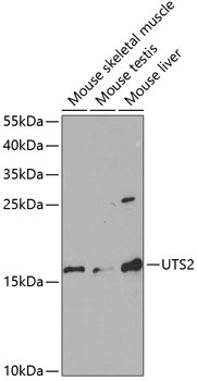 WB analysis of various samples using GTX16426 Urotensin II antibody. Dilution : 1:1000 Loading : 25ug per lane