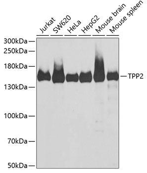 WB analysis of various samples using GTX16466 Tripeptidyl peptidase II antibody. Dilution : 1:1000 Loading : 25ug per lane
