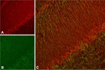 Anti-KV11.3_(erg3)_ - Expression of KV11.3 in rat cerebellum Immunohistochemical staining of rat cerebellum using Anti-Kv11.3 (erg3) antibody.