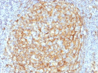 CD14 antibody [LPSR/2386]价格,详情介绍-960化工网 – 960化工网