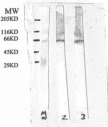 Western blot analysis of mouse brain extract (20ug/lane total protein) with chicken anti presenilin 1 (Lane 2) and chicken anti presenilin 2 (GTX18041) (Lane 3)