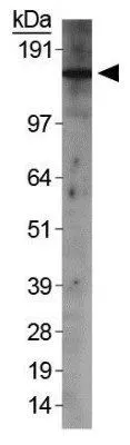 WB analysis of HeLa cell lysate using GTX20499 Rad50 antibody.