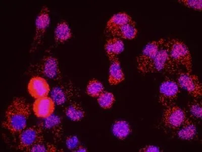 WB analysis of NCS treated(+; 200 ng/ml; 1h) or mock treated (-) HeLa cell using GTX21276 SMC1 (phospho Ser966) antibody. Dilution : 0.1 ug/ml