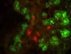 Double immunofluorescence microscopy after staining of mouse embryonic gut tissue with anti-Elastase antibody and anti-Insulin antibody.