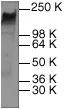 GTX22428 at a 1:200 dilution stainingSK-BR-3 whole cell lysate