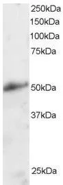 WB analysis of human kidney lysate using GTX22747 KLF8 antibody. Dilution : 2ug/ml Loading : 30ug protein in RIPA buffer