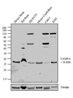 WB analysis of acid extracts (40 ug lysate) of Mouse Brain (Lane 1),Rat Brain (Lane 2),SH-SY5Y (Lane 3),Mouse Cerebellum (Lane 4),Caki-1 (Lane 5) and K562 (Lane 6) using GTX23348 VAMP4 antibody. Dilution : 0.5-3 ug/ml