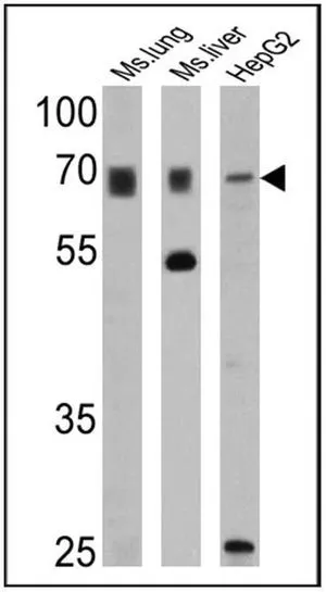 WB analysis of 25 ug of mouse lung (lane 1),mouse liver (lane 2) and HepG2 (lane 3) cell lysates using GTX23421 PMP70 antibody. Dilution : 1:1000