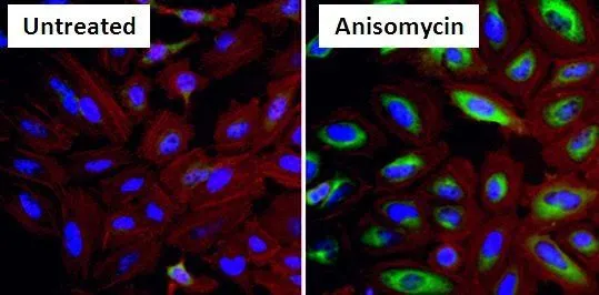 ICC/IF analysis of HeLa cells treated with 25ug of Anisomycin for 30 minutes using GTX25581 HSP27 (phospho Ser15) antibody.