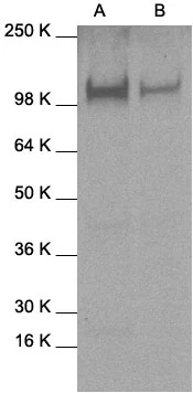 WB analysis of A431 (A) and HeLa (B) whole cell lysates using GTX27965 STAT2 antibody.