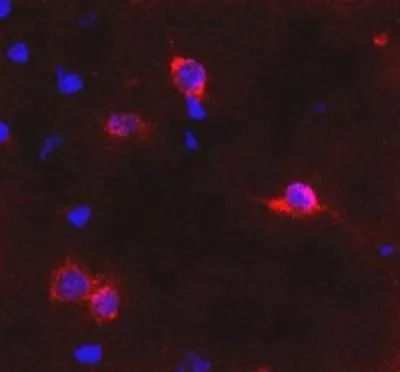 IHC-Fr analysis of mouse brain(trapezoid body) tissue using GTX31059 mGluR6 antibody.