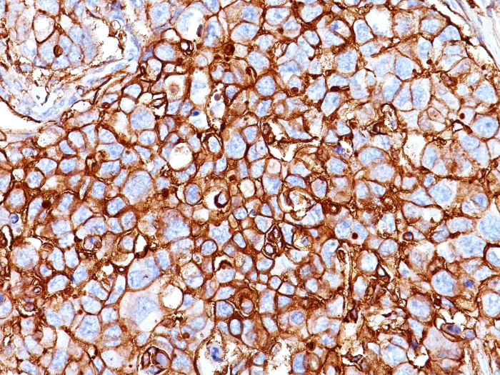 Western Blot of DU145 Cell Lysate using CD44 Monoclonal Antibody (HCAM/918).