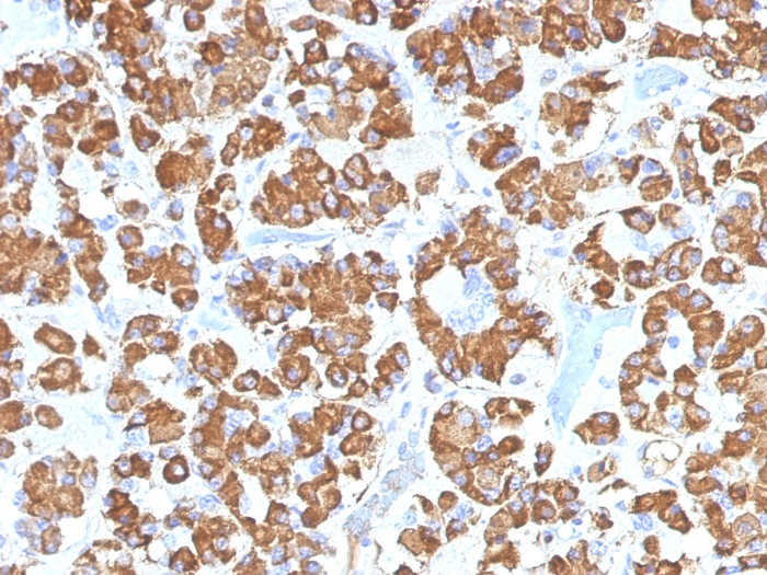 Formalin-fixed,paraffin-embedded Human Pituitary stained with Growth Hormone Monoclonal Antibody (GH/1450).