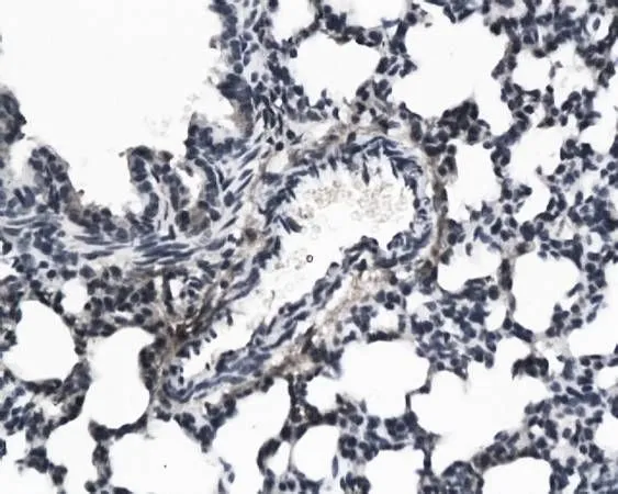IHC-P analysis of rat lung tissue using GTX37698 KGF antibody. Dilution : 1:200