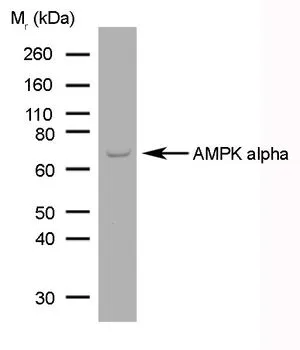 WB analysis of human brain tumour tissue lysate using GTX42788 AMPK alpha 1/2 antibody [84.1].