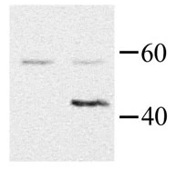 Ga1 6 detected by Western blot in transfected HEK293 cells (right lane)