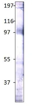 Western blot of Stra6 using GTX47857. Antibody dilution 1:500 in DiluObuffer,molecular weight markers are labeled on the left.