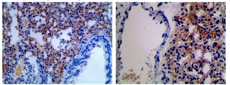 IHC-P analysis of 4% PFA fixed lung tissue sections from LPS exposed mouse using GTX53134 CD86 antibody [MAB0803].