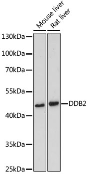 ICC/IF analysis of MCF-7 cell using GTX54039 DDB2 antibody. Blue : DAPI