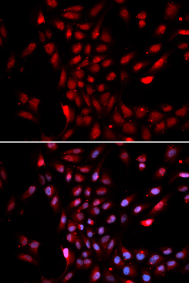 IHC-P analysis of rat heart tissue using GTX54358 KPNA4 antibody. Dilution : 1:100