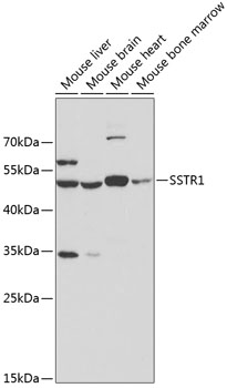 WB analysis of various samples using GTX54732 Somatostatin receptor 1 antibody. Dilution : 1:500 Loading : 25ug per lane