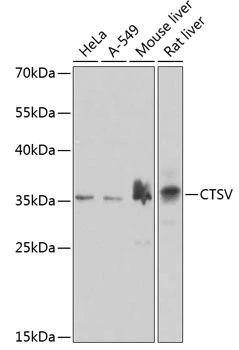 WB analysis of various sample lysates using GTX55550 Cathepsin V antibody. Dilution : 1:1000 Loading : 25microg per lane