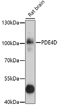 IHC-P analysis of human breast cancer tissue using GTX55741 PDE4D antibody. Dilution : 1:100