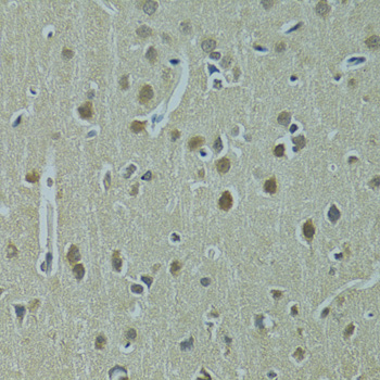IHC-P analysis of rat brain tissue using GTX55830 UBE2I antibody. Dilution : 1:100