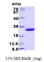 3?g mug protein (GTX57486-pro) by SDS-PAGE under reducing condition and visualized by coomassie blue stain.