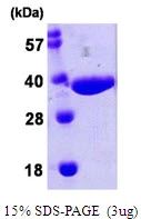 3?g nanA protein (GTX57487-pro) by SDS-PAGE under reducing condition and visualized by coomassie blue stain.